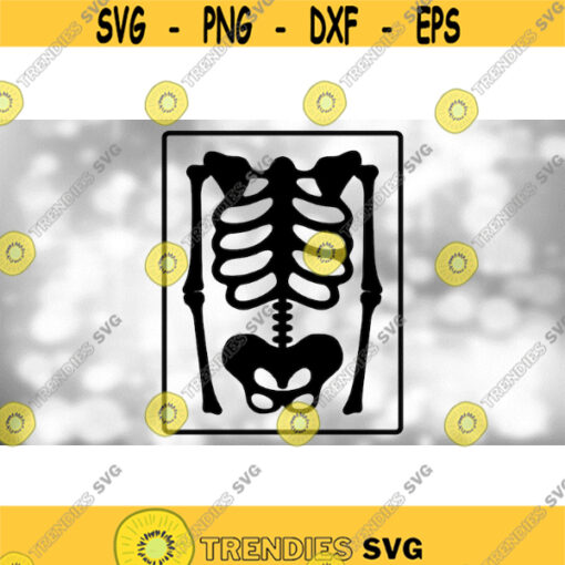 Medical Clipart Black Drawing of Skeleton X Ray of Torso Upper Body from Radiology for Doctors Radiologists Digital Download SVG PNG Design 654