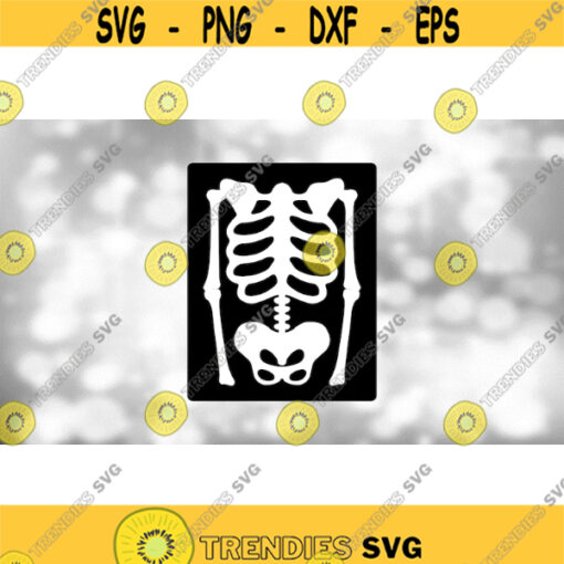 Medical Clipart White Skeleton X Ray of Torso or Upper Body Layered onto Black Rectangle RadiologyRadiologist Digital Download SVGPNG Design 1792
